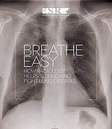 Breathe Easy: How radiology helps to find and fight lung diseases