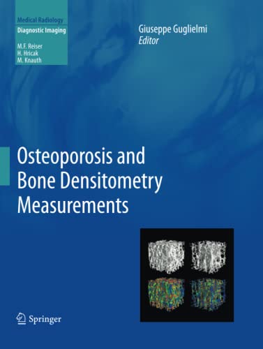 Osteoporosis and Bone Densitometry Measurements (Medical Radiology)