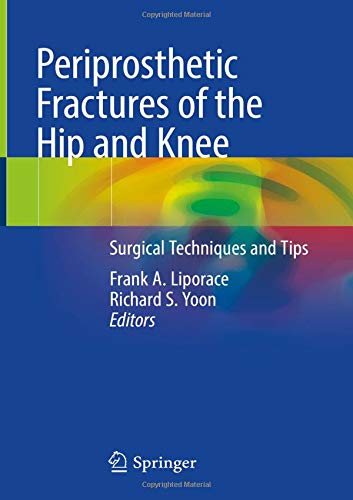 Periprosthetic Fractures of the Hip and Knee: Surgical Techniques and Tips