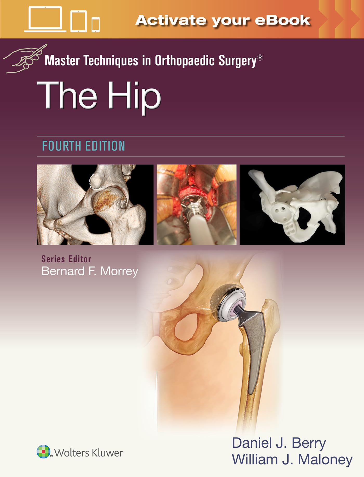 Master Techniques in Orthopaedic Surgery: The Hip: Print + eBook with Multimedia - Neuware