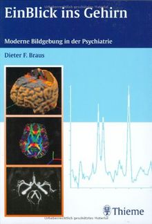 EinBlick ins Gehirn: Moderne Bildgebung in der Psychiatrie