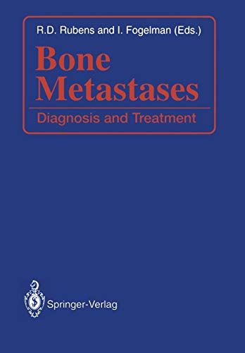Bone Metastases: Diagnosis And Treatment