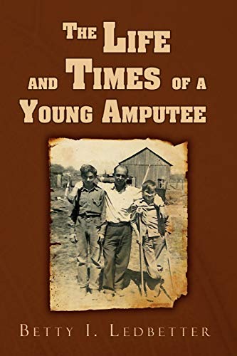 The Life And Times Of A Young Amputee