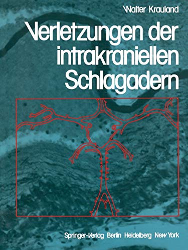 Verletzungen der intrakraniellen Schlagadern (German Edition)
