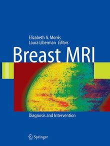 Breast MRI: Diagnosis and Intervention