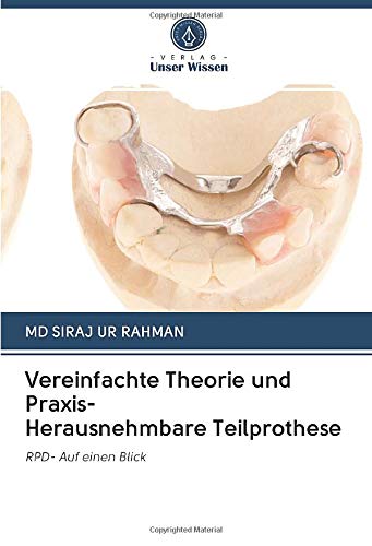 Vereinfachte Theorie und Praxis- Herausnehmbare Teilprothese: RPD- Auf einen Blick