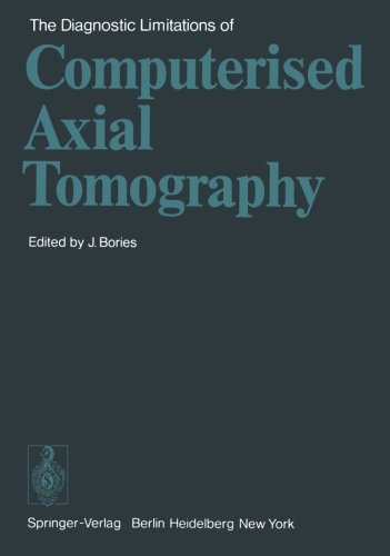 The Diagnostic Limitations of Computerized Axial Tomography