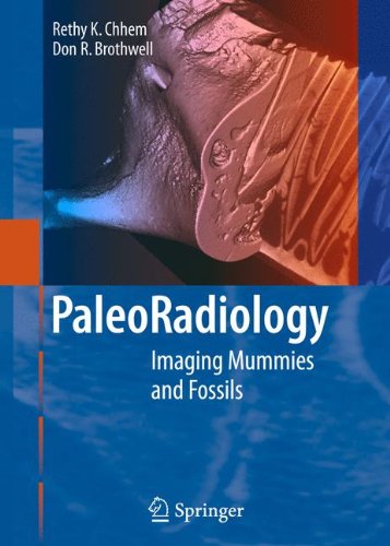 Paleoradiology: Imaging Mummies and Fossils