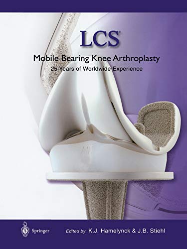 Mobile Bearing Knee Arthroplasty: A 25 Years Worldwide Review