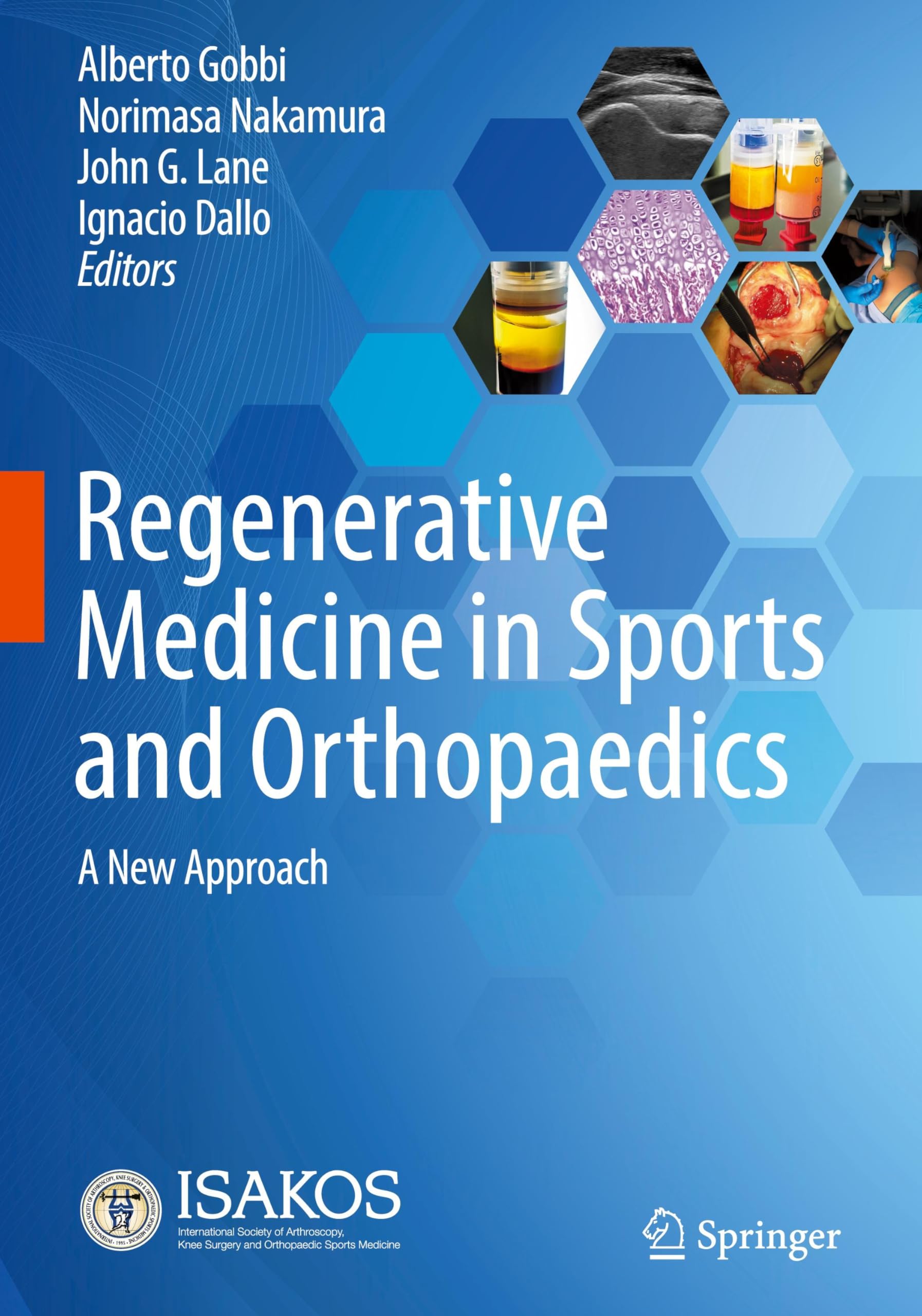 Regenerative Medicine in Sports and Orthopaedics: A New Approach