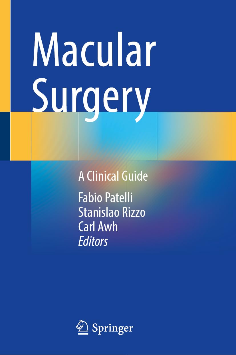 Macular Surgery: A Clinical Guide