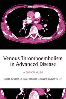 Venous Thromboembolism in Advanced Disease: A clinical guide