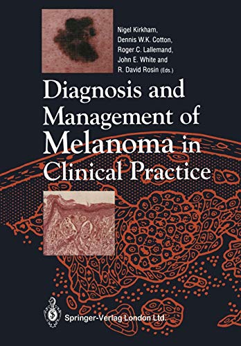 Diagnosis and Management of Melanoma in Clinical Practice