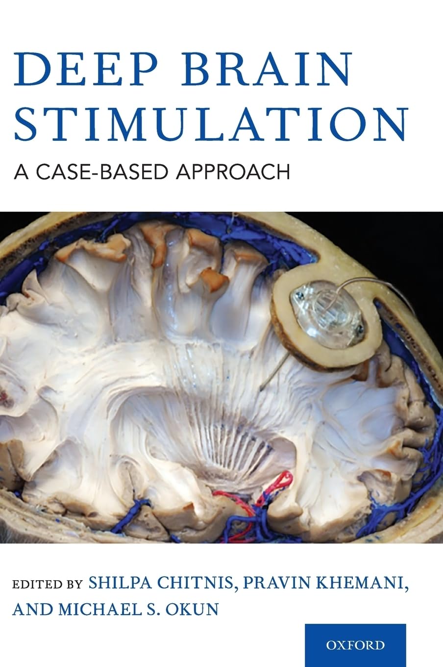 Deep Brain Stimulation: A Case-Based Approach