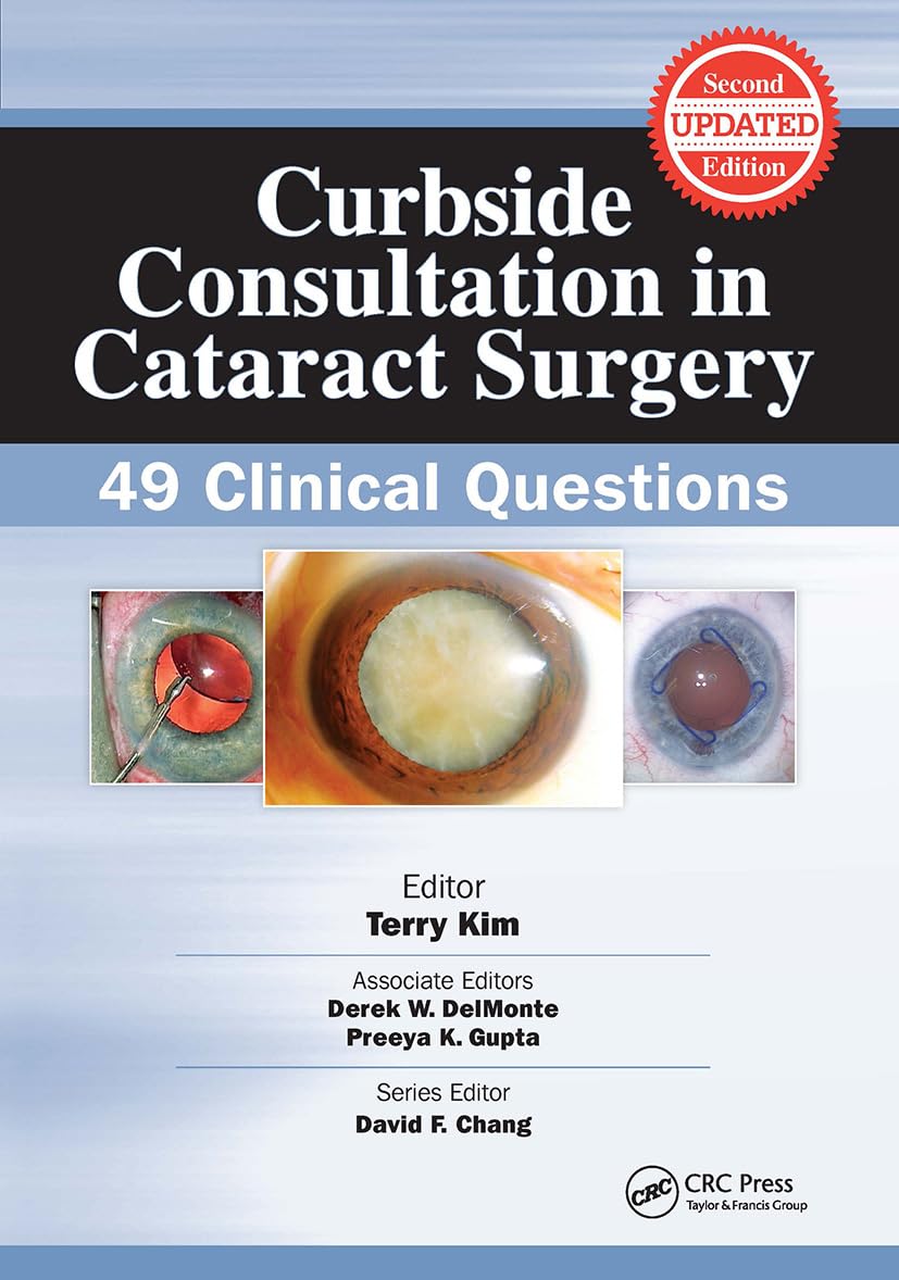 Curbside Consultation in Cataract Surgery: 49 Clinical Questions (Curbside Consultation in Ophthalmology)