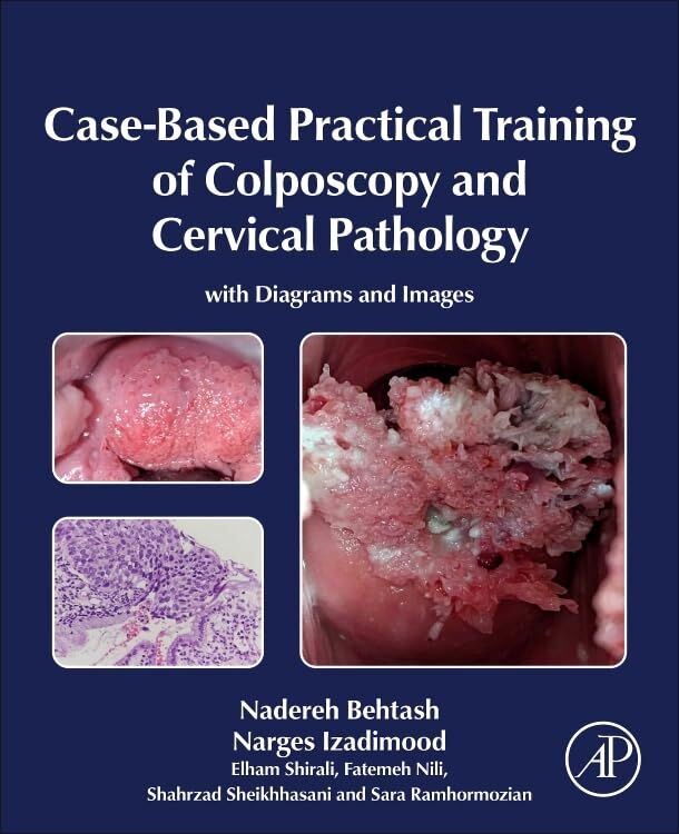 Case-Based Practical Training of Colposcopy and Cervical Pathology - Neuware