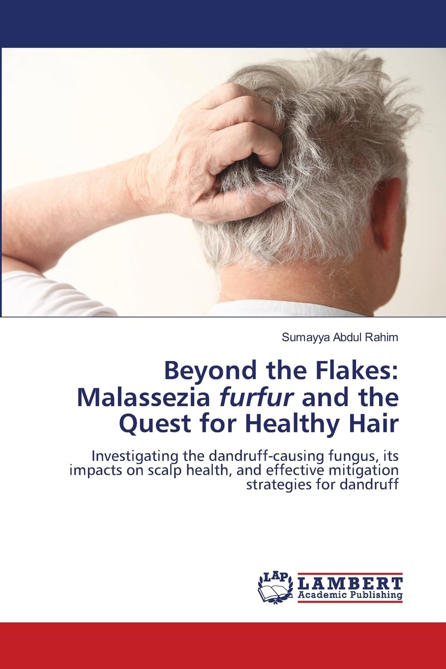 Beyond the Flakes: Malassezia furfur and the Quest for Healthy Hair: Investigating the dandruff-causing fungus, its impacts on scalp health, and effective mitigation strategies for dandruff