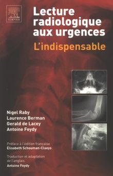 Lecture radiologique aux urgences : l'indispensable