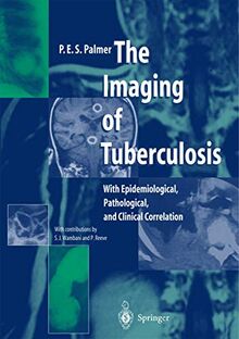 The Imaging of Tuberculosis: With Epidemiological, Pathological, and Clinical Correlation