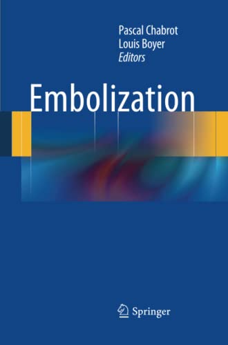 Embolization