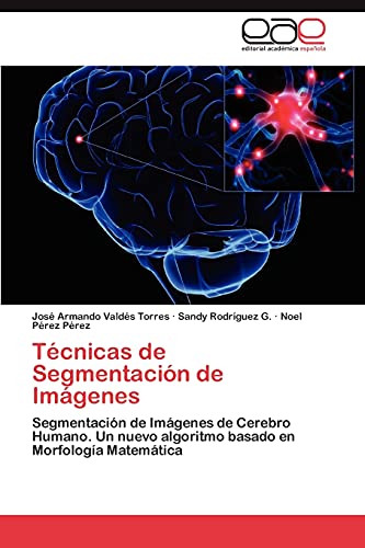 Técnicas de Segmentación de Imágenes: Segmentación de Imágenes de Cerebro Humano. Un nuevo algoritmo basado en Morfología Matemática