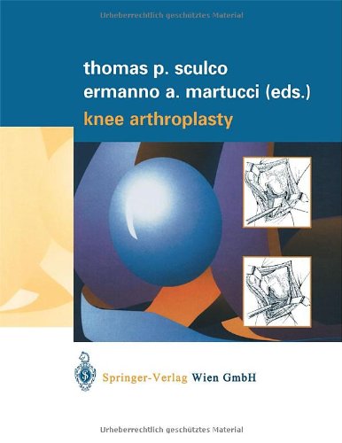 Knee Arthroplasty