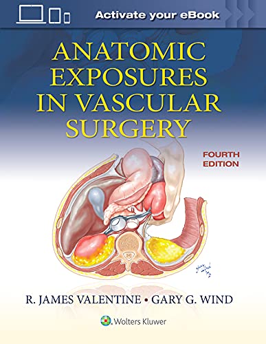 Gary Wind Anatomic Exposures In Vascular Surgery