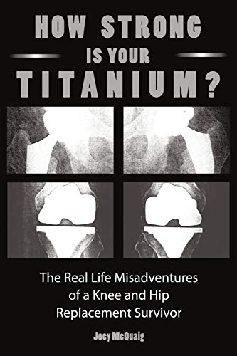 How Strong Is Your Titanium: The Real Life Misadventures of a Knee and Hip Replacement Survivor