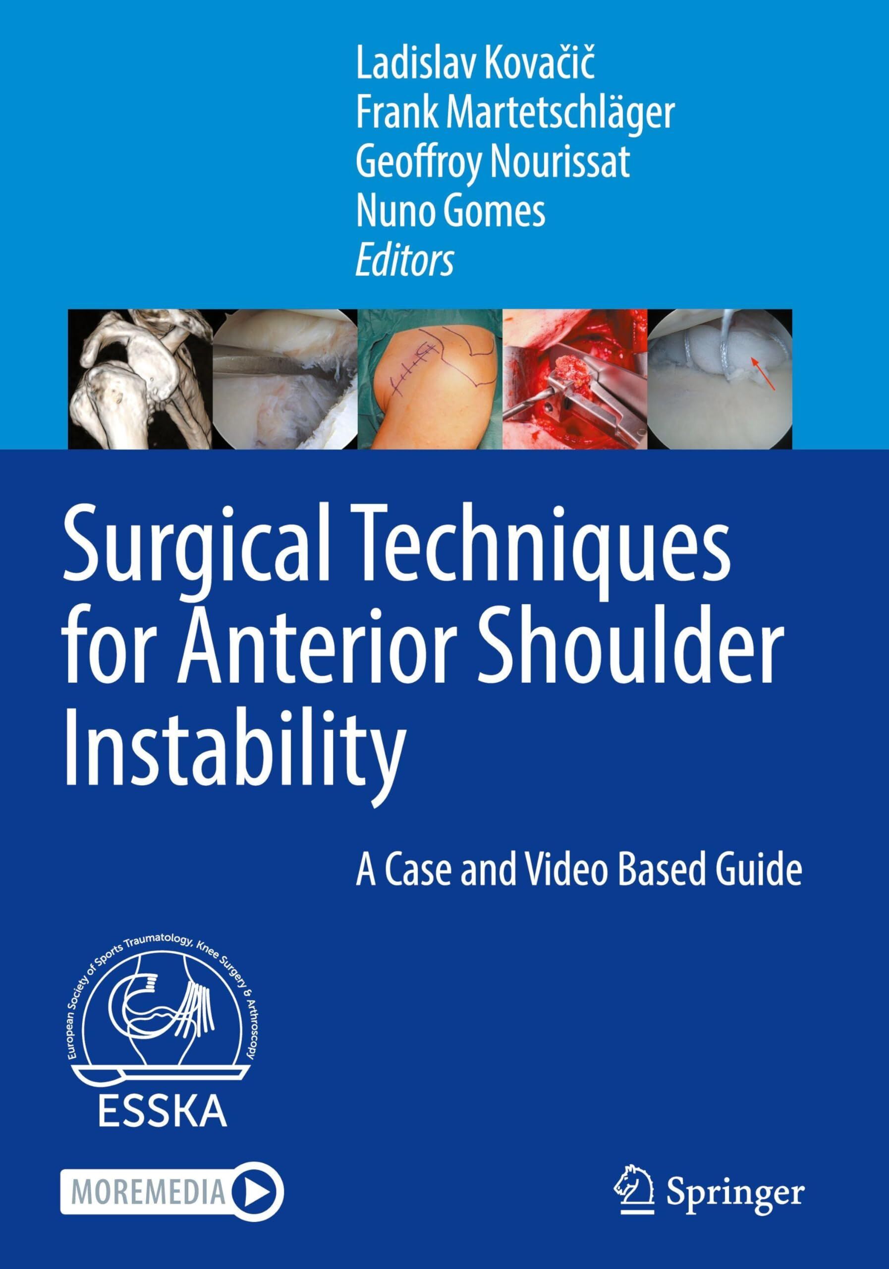 Surgical Techniques for Anterior Shoulder Instability