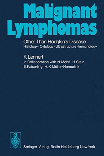 Malignant Lymphomas Other than Hodgkin’s Disease: Histology · Cytology · Ultrastructure · Immunology (Handbuch der speziellen pathologischen Anatomie und Histologie)