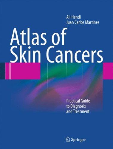 Atlas of Skin Cancers: Practical Guide to Diagnosis and Treatment