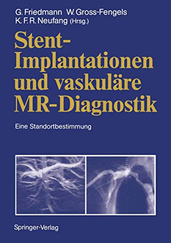Stent-Implantationen und vaskuläre MR-Diagnostik: Eine Standortbestimmung (German Edition)