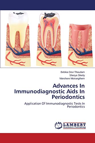 Advances In Immunodiagnostic Aids In Periodontics: Application Of Immunodiagnostic Tests In Periodontics