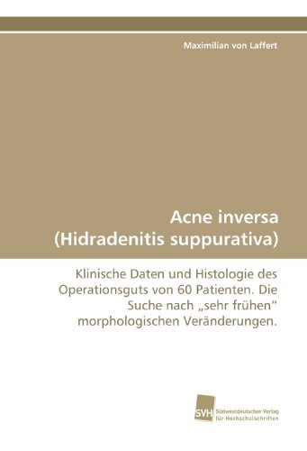 Acne inversa (Hidradenitis suppurativa): Klinische Daten und Histologie des Operationsguts von 60 Patienten. Die Suche nach „sehr frühen“ morphologischen Veränderungen.