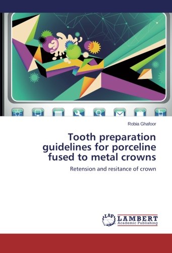 Tooth preparation guidelines for porceline fused to metal crowns: Retension and resitance of crown