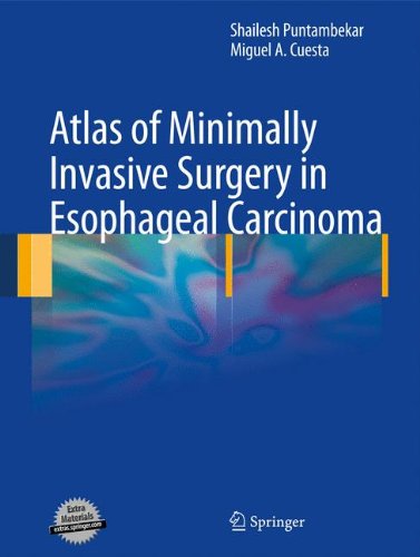 Atlas of Minimally Invasive Surgery in Esophageal Carcinoma