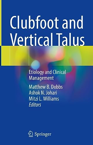 Clubfoot and Vertical Talus: Etiology and Clinical Management