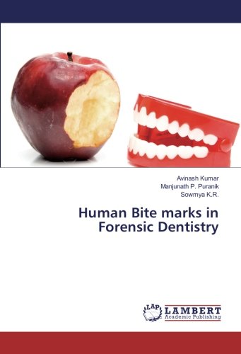 Human Bite marks in Forensic Dentistry