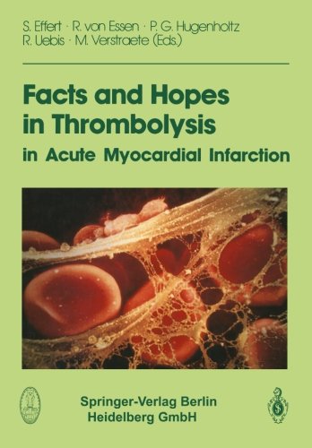 Facts and Hopes in Thrombolysis in Acute Myocardial Infarction