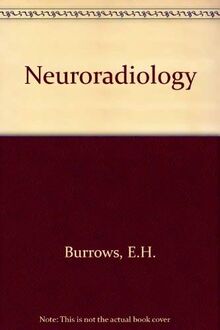 Neuroradiology