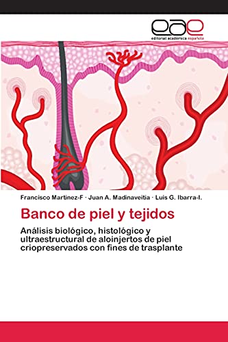 Banco de piel y tejidos: Análisis biológico, histológico y ultraestructural de aloinjertos de piel criopreservados con fines de trasplante