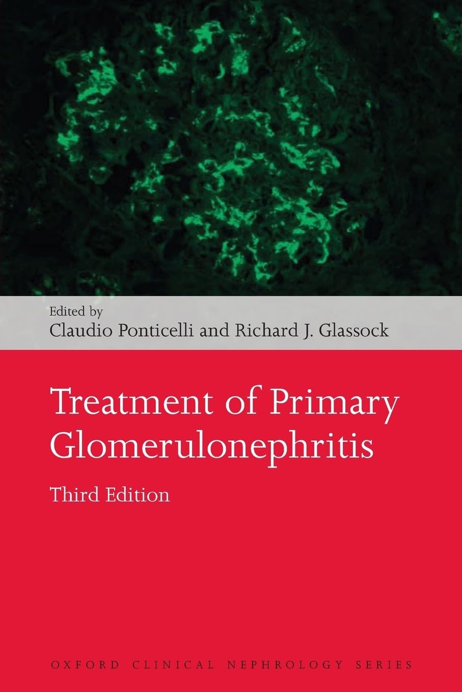 Treatment of Primary Glomerulonephritis (Oxford Clinical Nephrology)