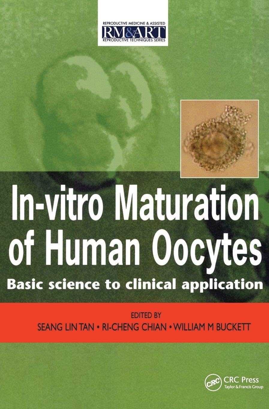 In Vitro Maturation of Human Oocytes: Basic Science to Clinical Applications (Reproductive Medicine and Asst. Reproduction, 3, Band 3)