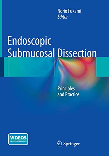 Endoscopic Submucosal Dissection: Principles and Practice