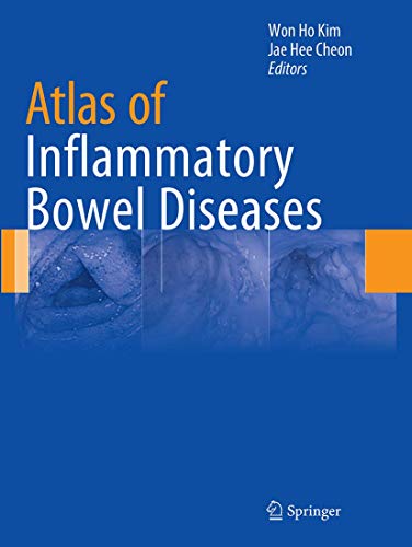Atlas of Inflammatory Bowel Diseases