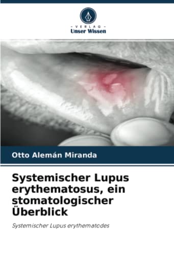 Systemischer Lupus erythematosus, ein stomatologischer Überblick: Systemischer Lupus erythematodes
