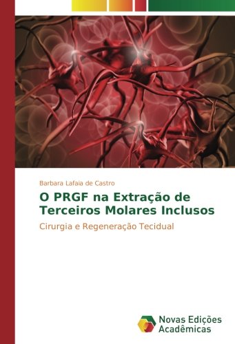 O PRGF na Extração de Terceiros Molares Inclusos: Cirurgia e Regeneração Tecidual