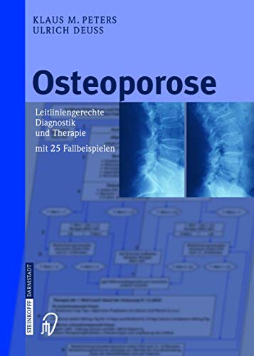 Osteoporose: Leitliniengerechte Diagnostik und Therapie mit 25 Fallbeispielen