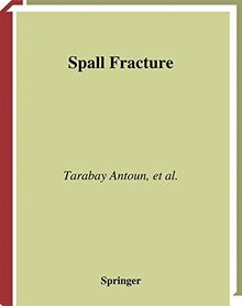Spall Fracture (Shock Wave and High Pressure Phenomena)