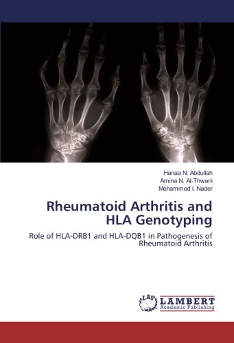 Rheumatoid Arthritis and HLA Genotyping: Role of HLA-DRB1 and HLA-DQB1 in Pathogenesis of Rheumatoid Arthritis